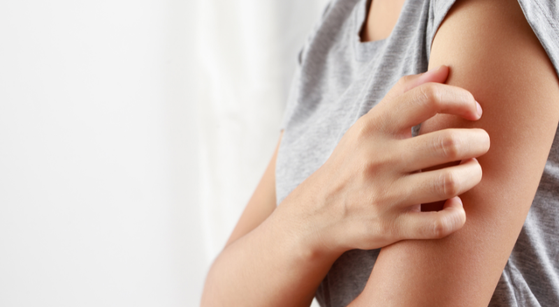 Fnat: symptomer, smitte og behandling